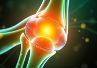 Hyalofast i rehabilitacja po przeszczepie chondrocytów – co warto wiedzieć?